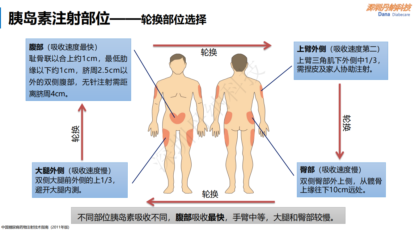 注射部位选择.png